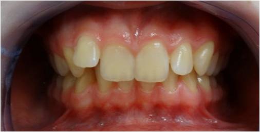 Stan przed leczeniem